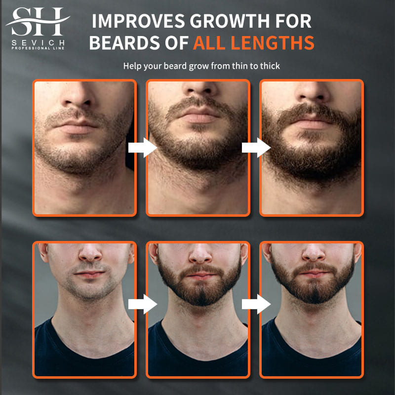 Sevich Men Beard Growth Essent – Hair Care Oil Serum recenzja i cena