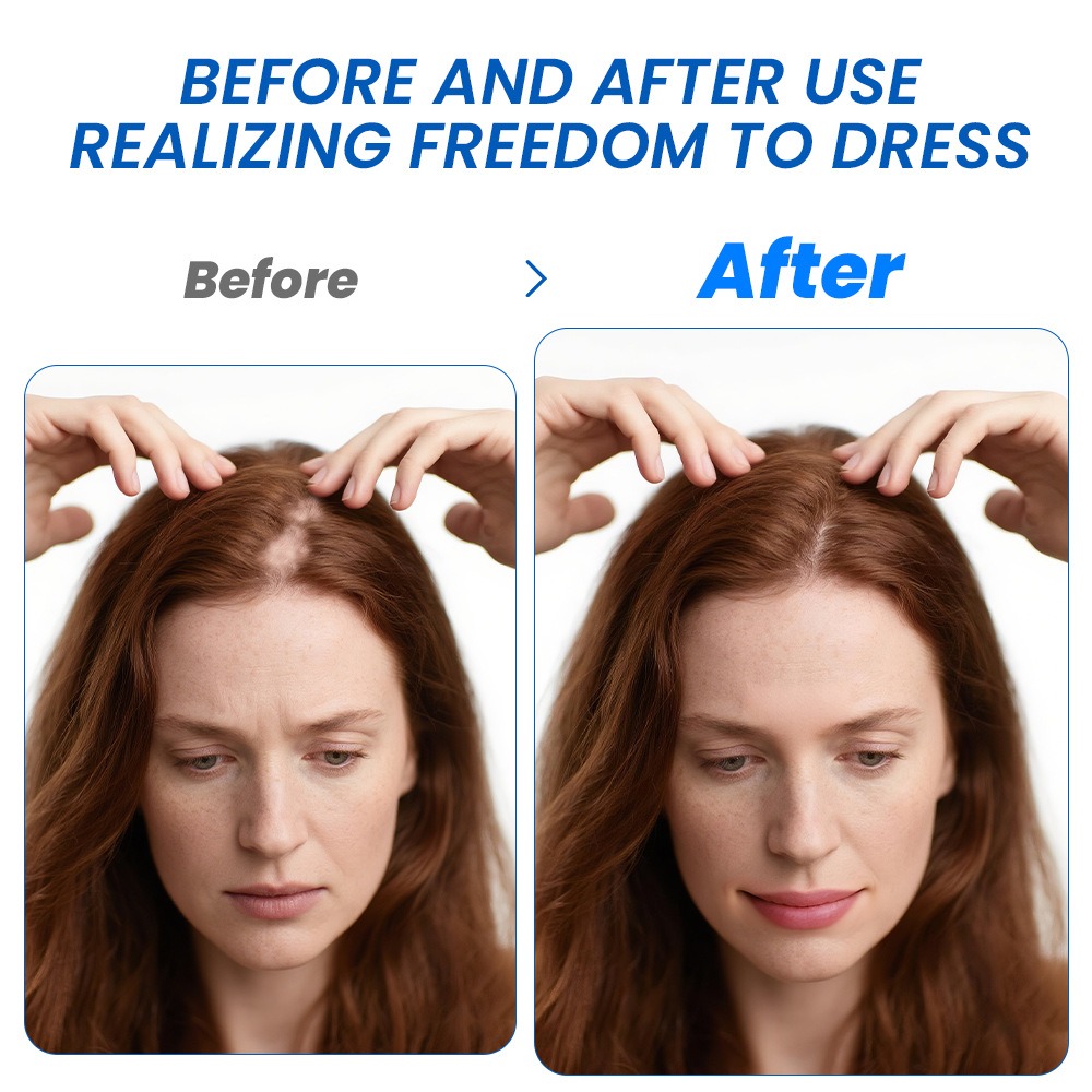 Alopecia Hair Growth Spray Sop – Hair Care Lotion recenzja i cena