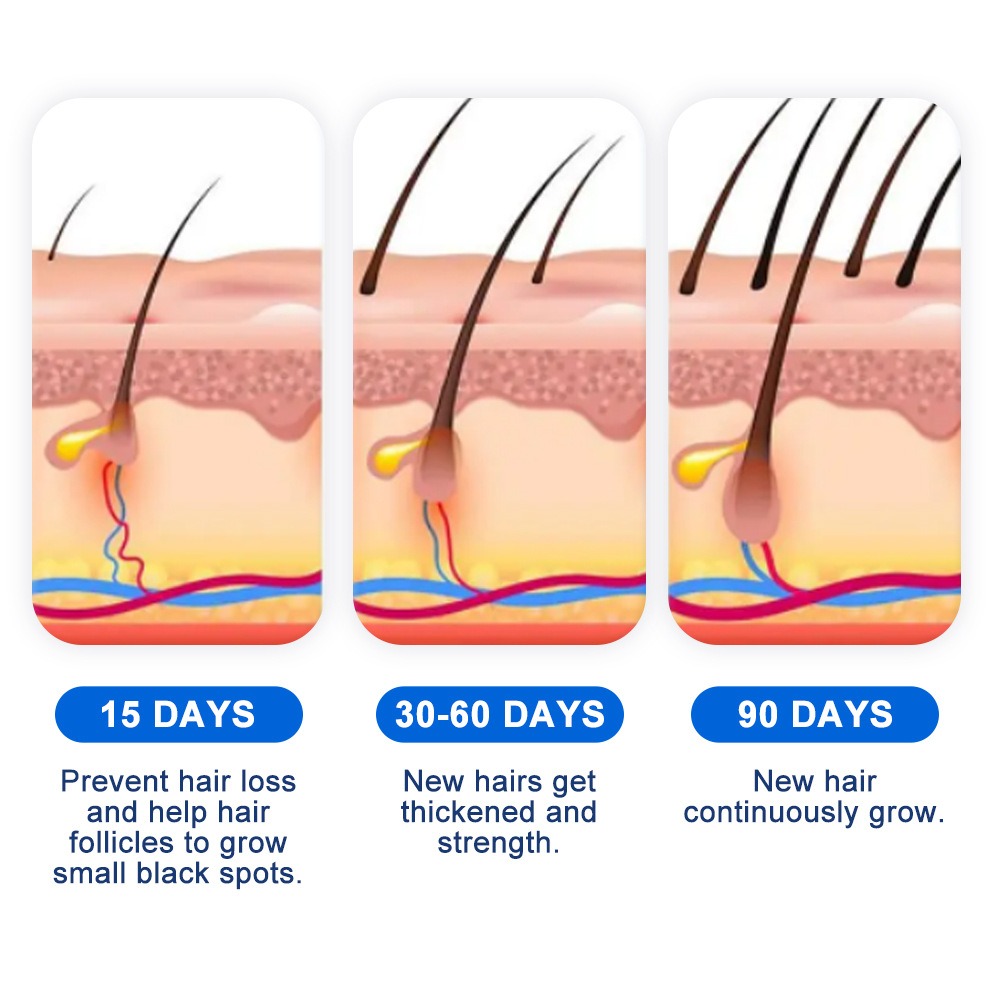 Alopecia Hair Growth Spray Sop – Hair Care Lotion recenzja i cena
