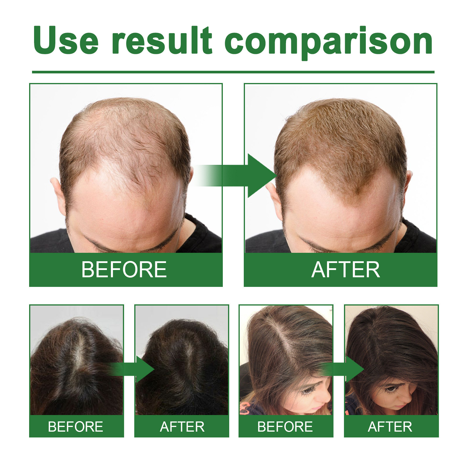 Rosemary Spray for Hair Nouris – Hair Care Naturally recenzja i cena
